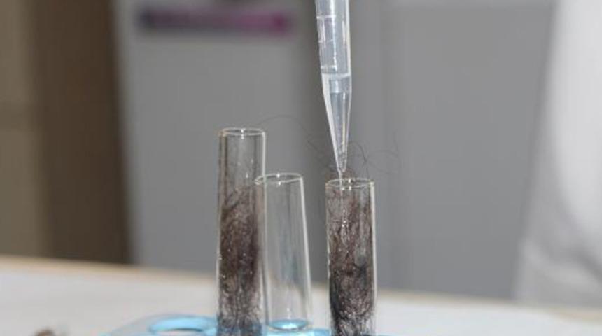 Çiftçilerin saçlarında kalıntılarına rastlandı: Birçok kanser türüne neden oluyor