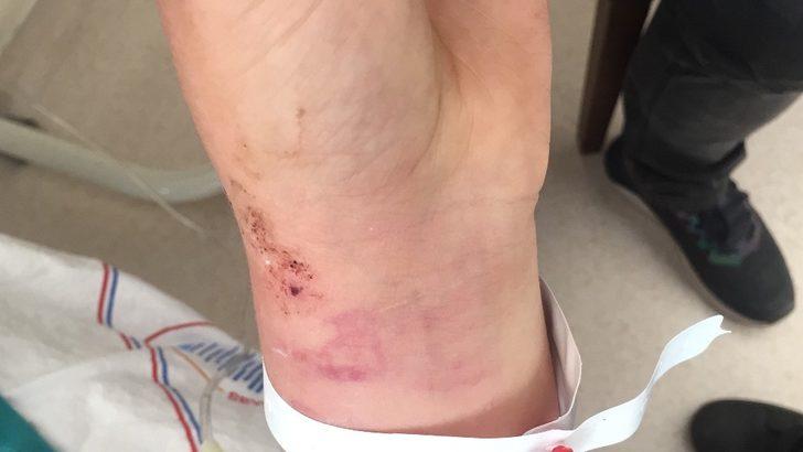 Dayakçı kocadan ilginç savunma: "Eşimi sakinleştirmek için kolunu ısırdım" G2