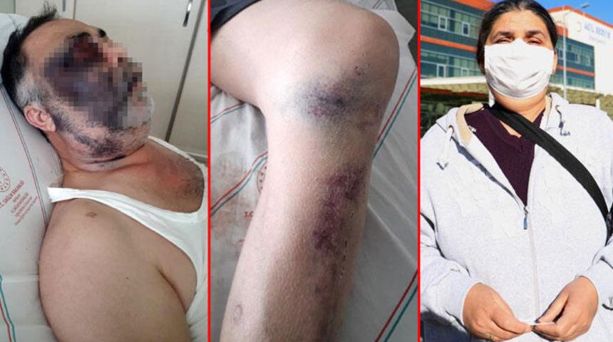 Antalya'daki engelli adama darpta yeni gelişme!