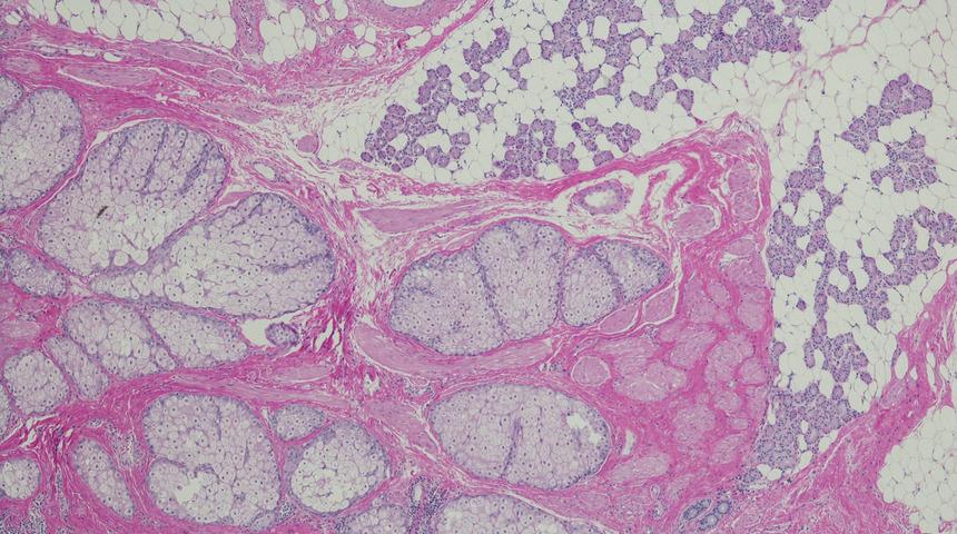 Uzmanlardan nadir hastalık uyarısı: 7 binden fazla çeşidi var! Her ay yenileri çıkıyor 