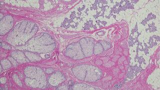 Uzmanlardan nadir hastalık uyarısı: 7 binden fazla çeşidi var! Her ay yenileri çıkıyor 