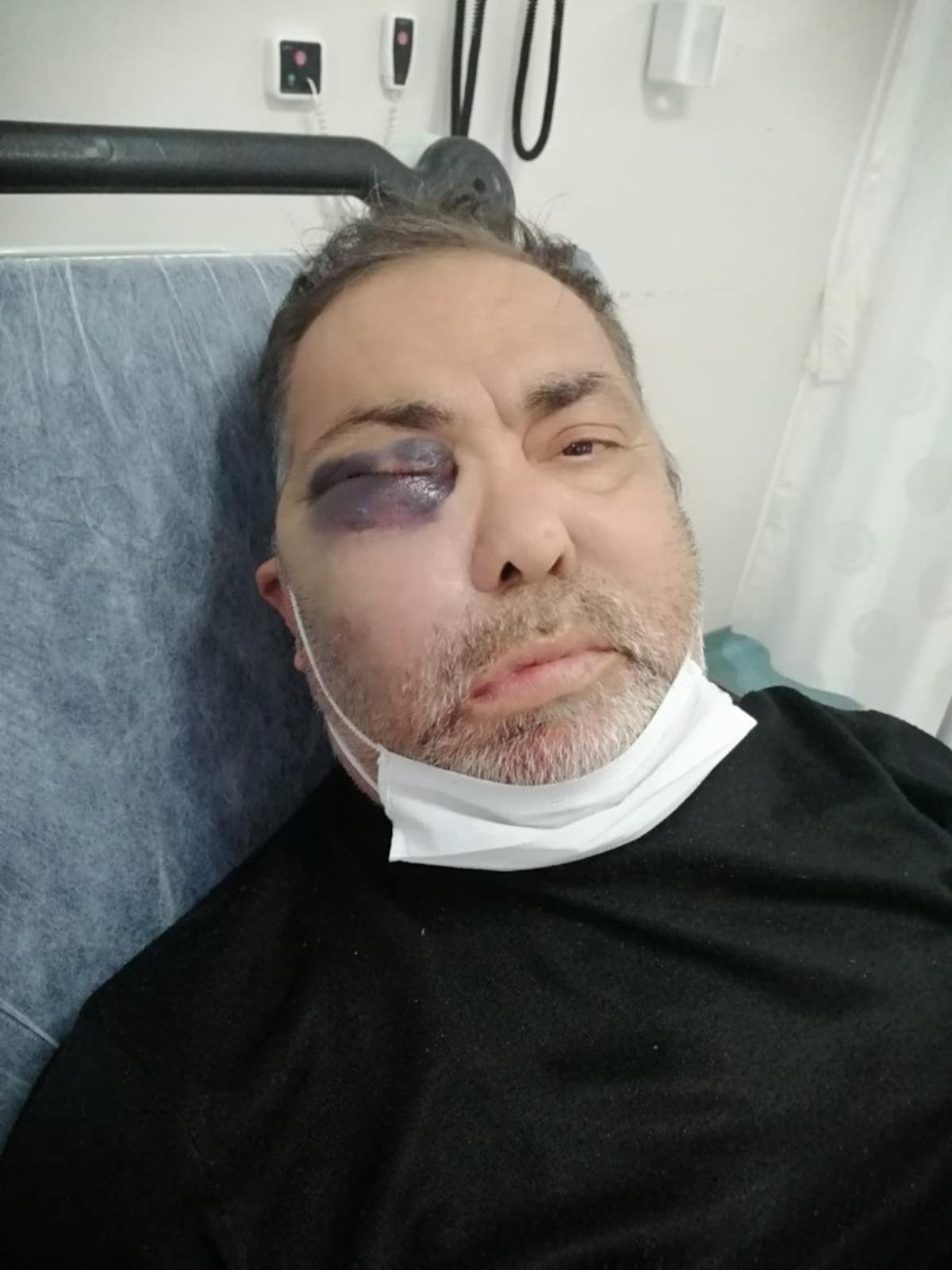 Darp edilen y&uuml;zde 90 engelli vatandaş olayında tutuklama kararı