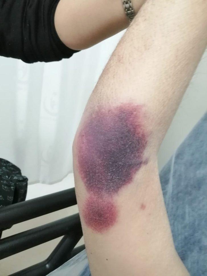 Darp edilen yüzde 90 engelli vatandaş olayında tutuklama kararı G2