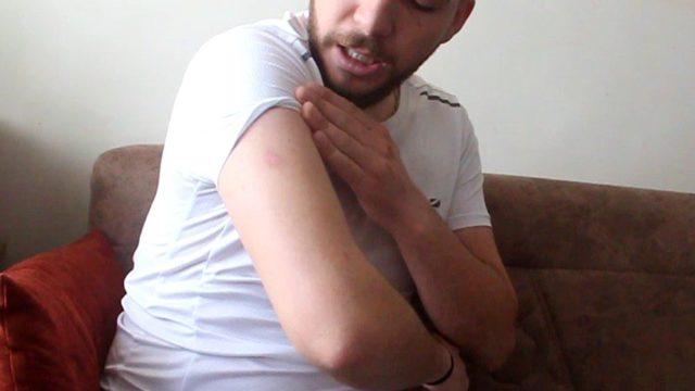 Patlayan cep telefonu yaraladı