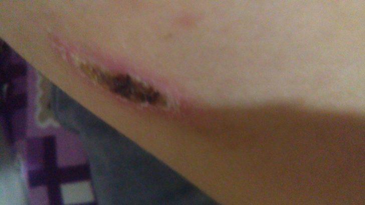 Patlayan cep telefonu yaraladı G2