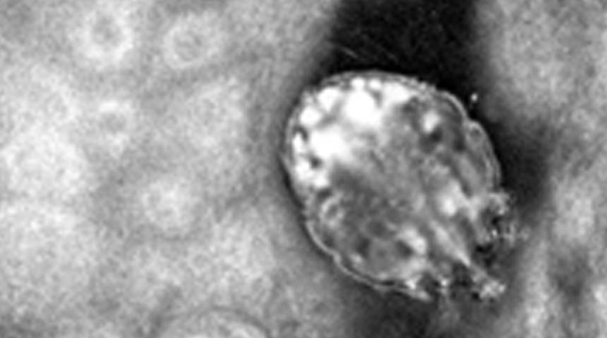 Pandemide dirençli uyuz vakalarında patlama yaşandı: Koronavirüs ile karıştırılabilir