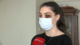 Telefonda video izlediği için kocasının feci şekilde dövdüğü kadın: Ölmeyi mi bekleyeyim?