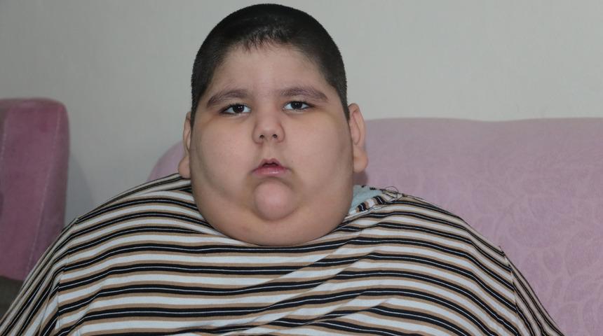 5 yaşında 90 kiloya ulaştı! 'Kilo artışının önüne geçemiyoruz'