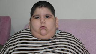 5 yaşında 90 kiloya ulaştı! 'Kilo artışının önüne geçemiyoruz'