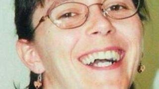 ABD’de ikinci kez yüz nakli yapılan kadın ilk kez basın karşısında