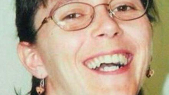 ABD’de ikinci kez yüz nakli yapılan kadın ilk kez basın karşısında