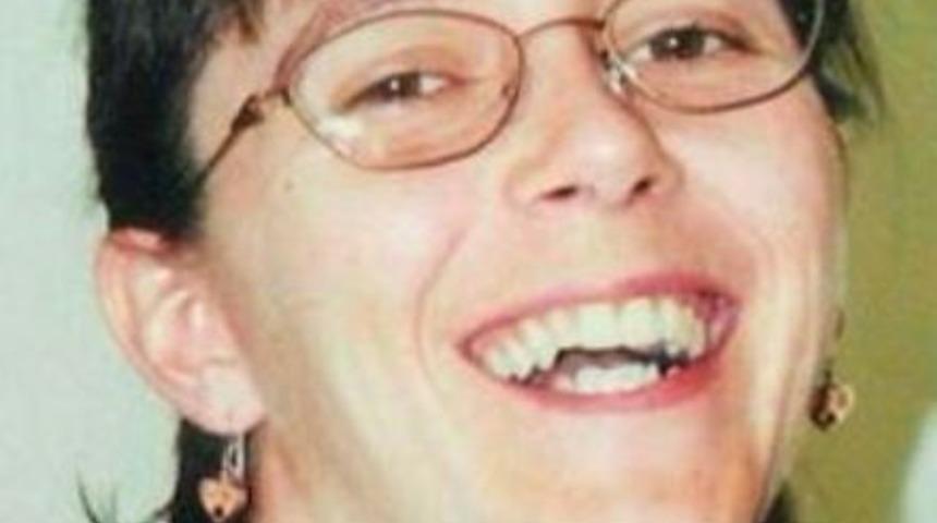 ABD’de ikinci kez yüz nakli yapılan kadın ilk kez basın karşısında