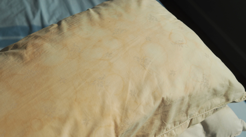 Yastığınızı iki yıldan fazla kullanıyorsanız korkunç: Derileriniz toz akarları için bir ziyafet!