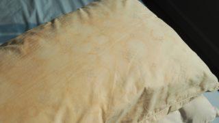 Yastığınızı iki yıldan fazla kullanıyorsanız korkunç: Derileriniz toz akarları için bir ziyafet!