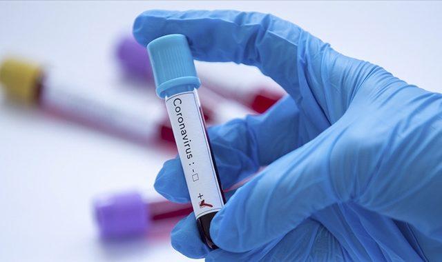 Koronavirüs Testi Haberleri Ve Son Dakika Koronavirüs Testi Haberleri