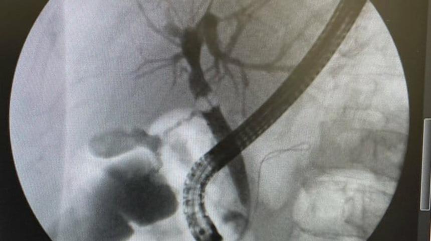 Ağrı&rsquo;da başarılı operasyon