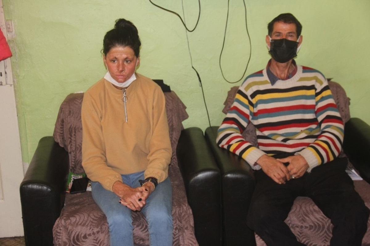 Bitlenen sa&ccedil;larını benzinle yıkamak isterken kendini yakan kız yardım eli bekliyor