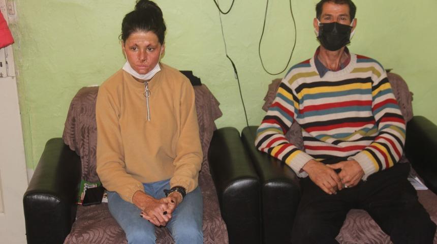 Bitlenen saçlarını benzinle yıkamak isterken kendini yakan Gözde yardım eli bekliyor