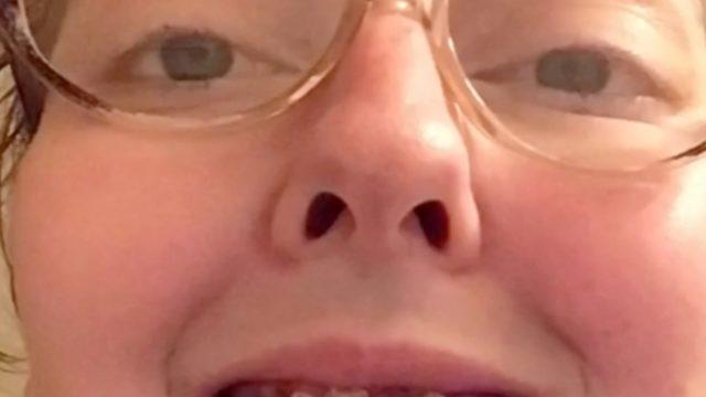 Ağzında tek dişi kalmadı, bir de uyarıda bulundu: Dişlerinize iyi bakın!