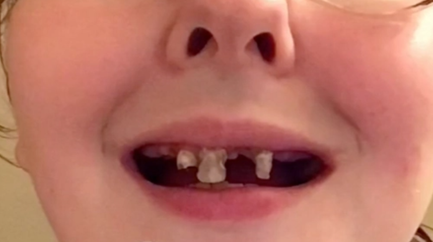 Ağzında tek dişi kalmadı, bir de uyarıda bulundu: Dişlerinize iyi bakın!