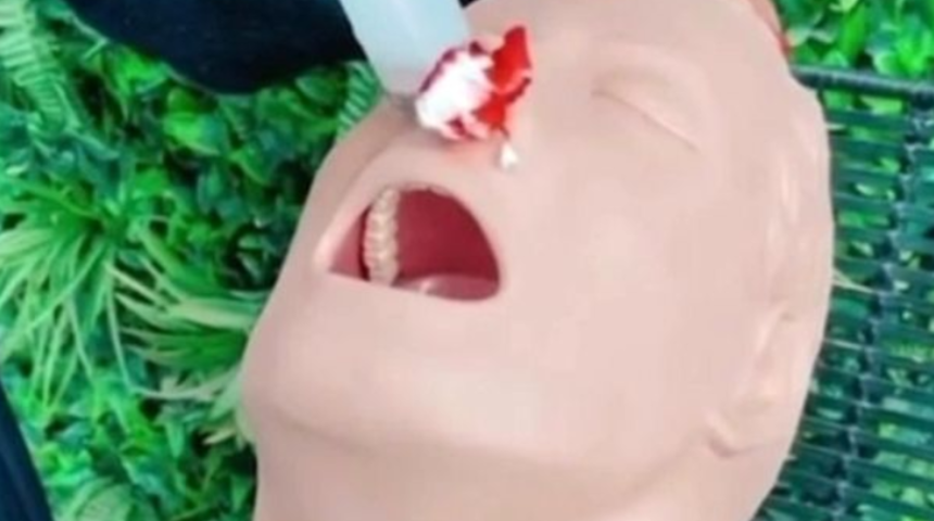 Burun kanaması sırasında asla çocuğunuzun başını arkaya doğru eğmeyin!