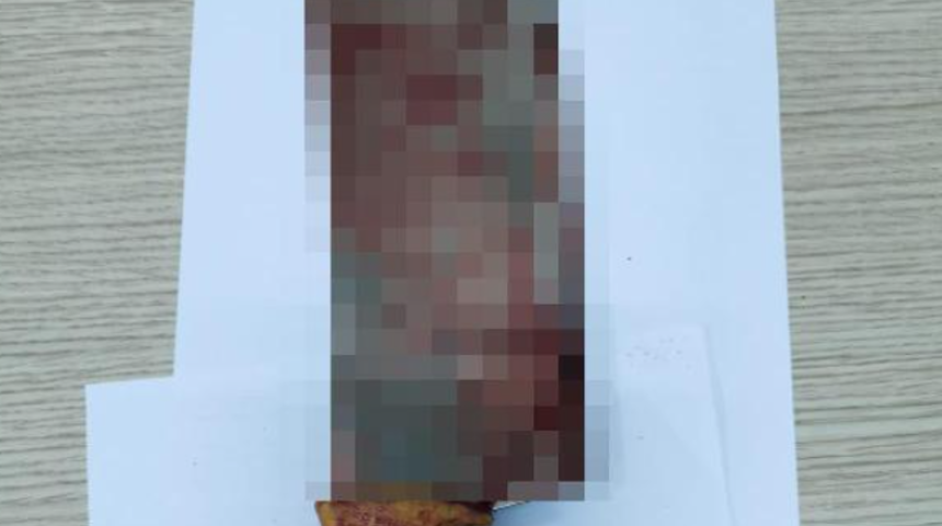 Eşe satırlı saldırı! Barışma teklifini reddetti diye eşini 10 yerinden yaraladı