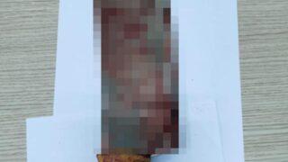 Eşe satırlı saldırı! Barışma teklifini reddetti diye eşini 10 yerinden yaraladı