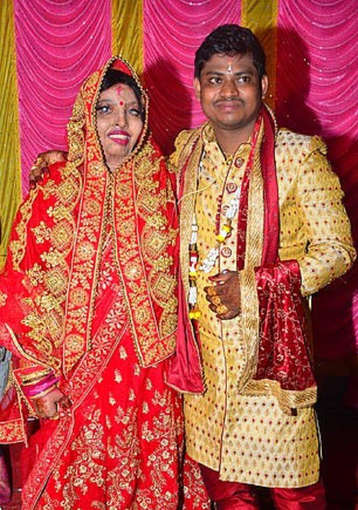 Hindistan’da asitli saldırıya uğrayan kadın gerçek aşkı 13 yıl sonra buldu G2