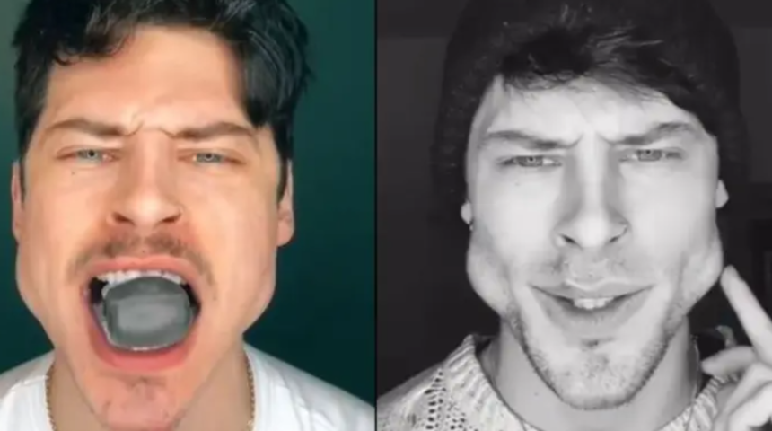 Yüzün çok yuvarlak denildi! İki ay sonunda yüzü bu hale geldi, çizgi film karakterine benzetildi