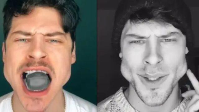 Yüzün çok yuvarlak denildi! İki ay sonunda yüzü bu hale geldi, çizgi film karakterine benzetildi