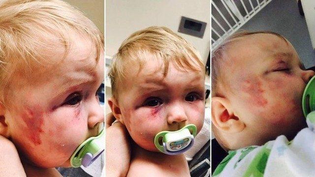 Sekiz aylık kızını öldüresiye dövdü! Ceza almadı