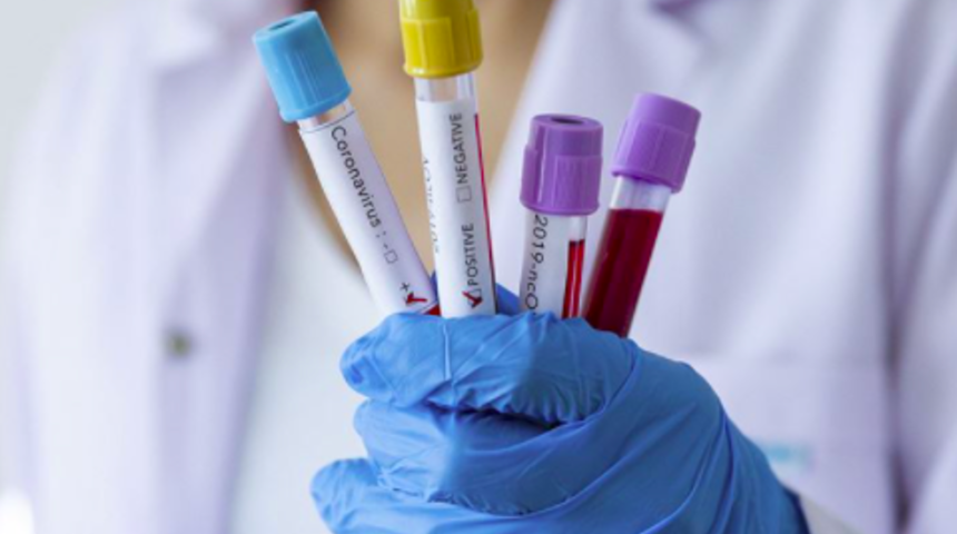 13 Nisan koronavirüs tablosu açıklandı mı? Korona tablosu vaka ve ölüm sayılarında son durum