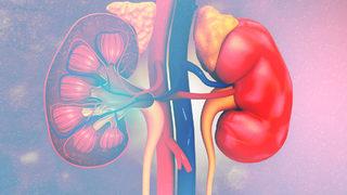 Böbrek hastalığına bu yanlışlar neden oluyor! Önlemek mümkün