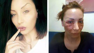 Kuaför salonunda yaptırdığı 'örümcek ağı' hayatını kabusa çevirdi