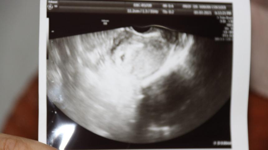 İmkansız olduğu söylenmişti ama 9  yıl sonra hayallerine kavuştu