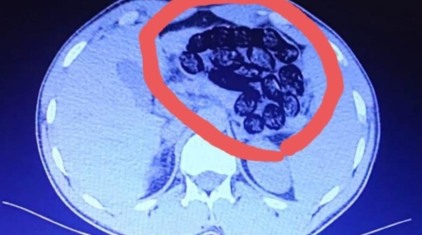 İzmir uçağına bineceklerdi! 2 İranlı'nın mide filmi şaşkına çevirdi