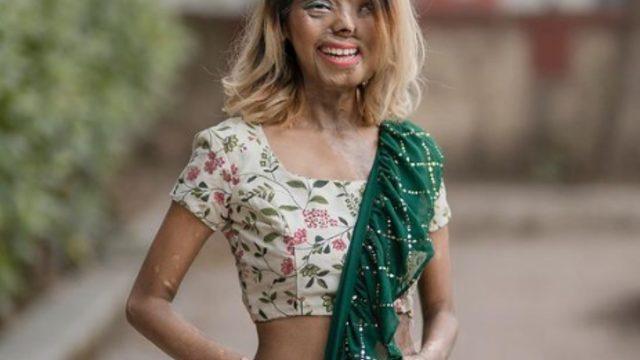 Öz babasının asitli saldırısına uğradıktan sonra yüzünü kaybeden Anmol Rodriguez, sosyal medyada fenomen oldu