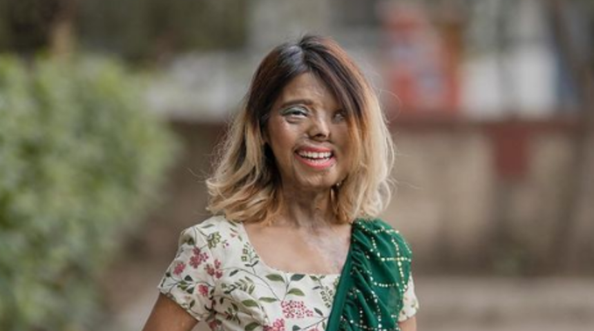 Öz babasının asitli saldırısına uğradıktan sonra yüzünü kaybeden Anmol Rodriguez, sosyal medyada fenomen oldu