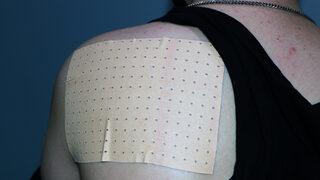 Ağrı ve sızıya karşı kullanıyoruz ama... Yakı bandı uyarısı: Doğru kullanılmadığında zarar veriyor