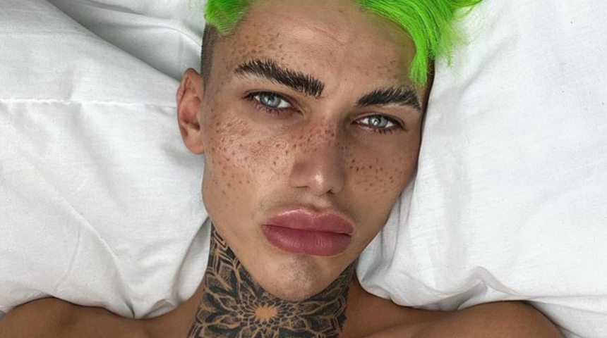 Ameliyat masasından kalkmıyor! Tek amacı Instagram filtresi gibi görünmek