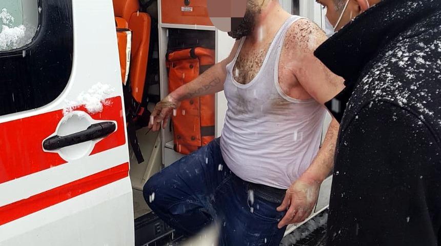 Ailesiyle tartışan kepçe operatörü kendini yaktı