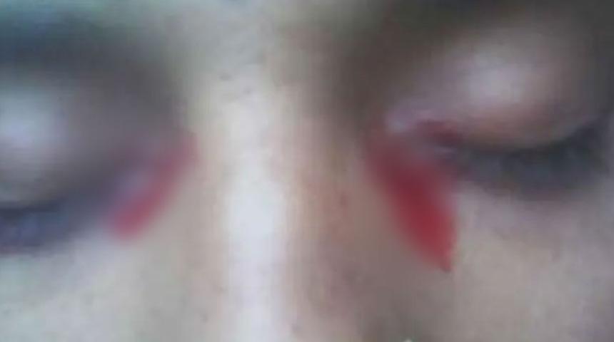 Nedenine çok şaşıracaksınız! Gözlerinden yaş yerine kan akıyor