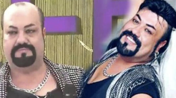 Kobra Murat peruğunu çıkarınca olanlar oldu! Bu hâliyle şoke etti G2