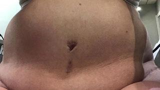 'Vücudun kum saati gibi olacak' denildi, şimdi oturamıyor bile!