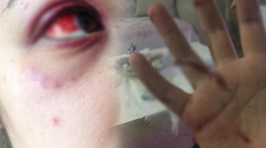 Kız arkadaşını darp eden avukata uzaklaştırma kararı