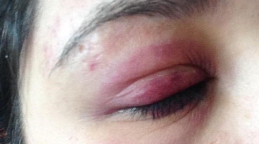 Gen&ccedil; kızı darp eden avukat: &ldquo;Alkol&uuml; d&ouml;kt&uuml;m diye şişe fırlatıp tokat attı&rdquo;