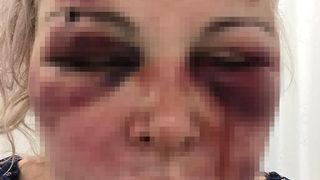 Rus kadın otelde dehşeti yaşamıştı! Korku dolu anları böyle anlattı