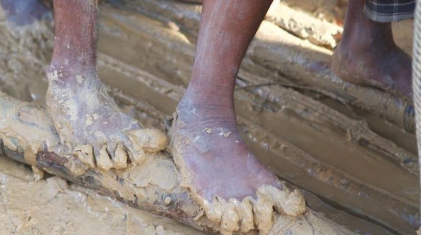 D&uuml;nyada 40 milyon 'modern k&ouml;le' var