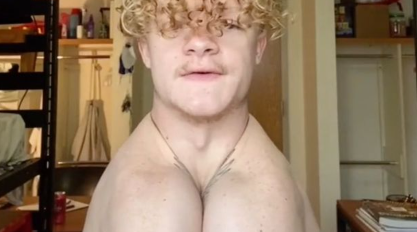 Milyonda bir! Köprücük kemiği olmadan doğan adam yaptıklarıyla şaşkına çeviriyor