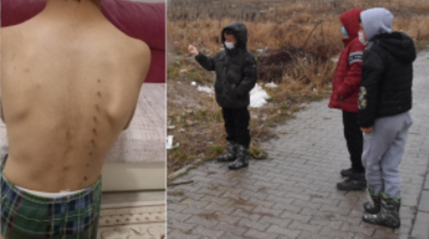 K&uuml;tahya'da k&ouml;peklerle oynayan 3 &ccedil;ocuğa tırmıkla saldıran hemşire tutuklandı